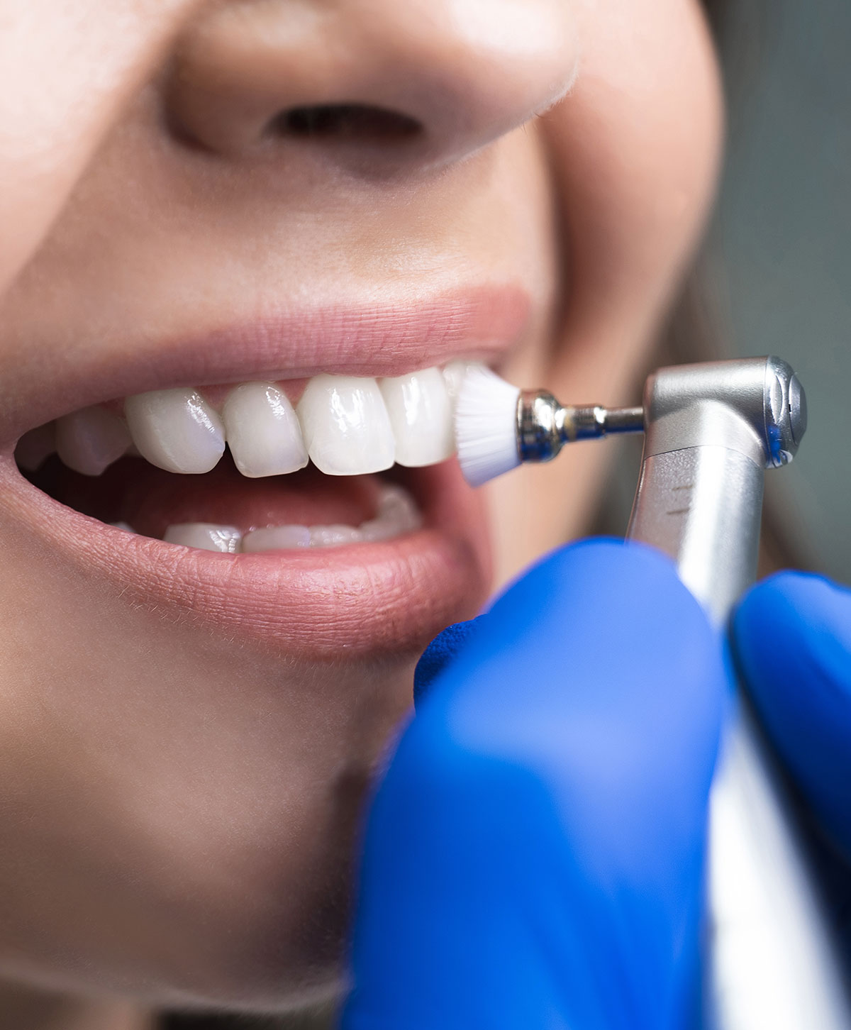 Close Up denti durante pulizia